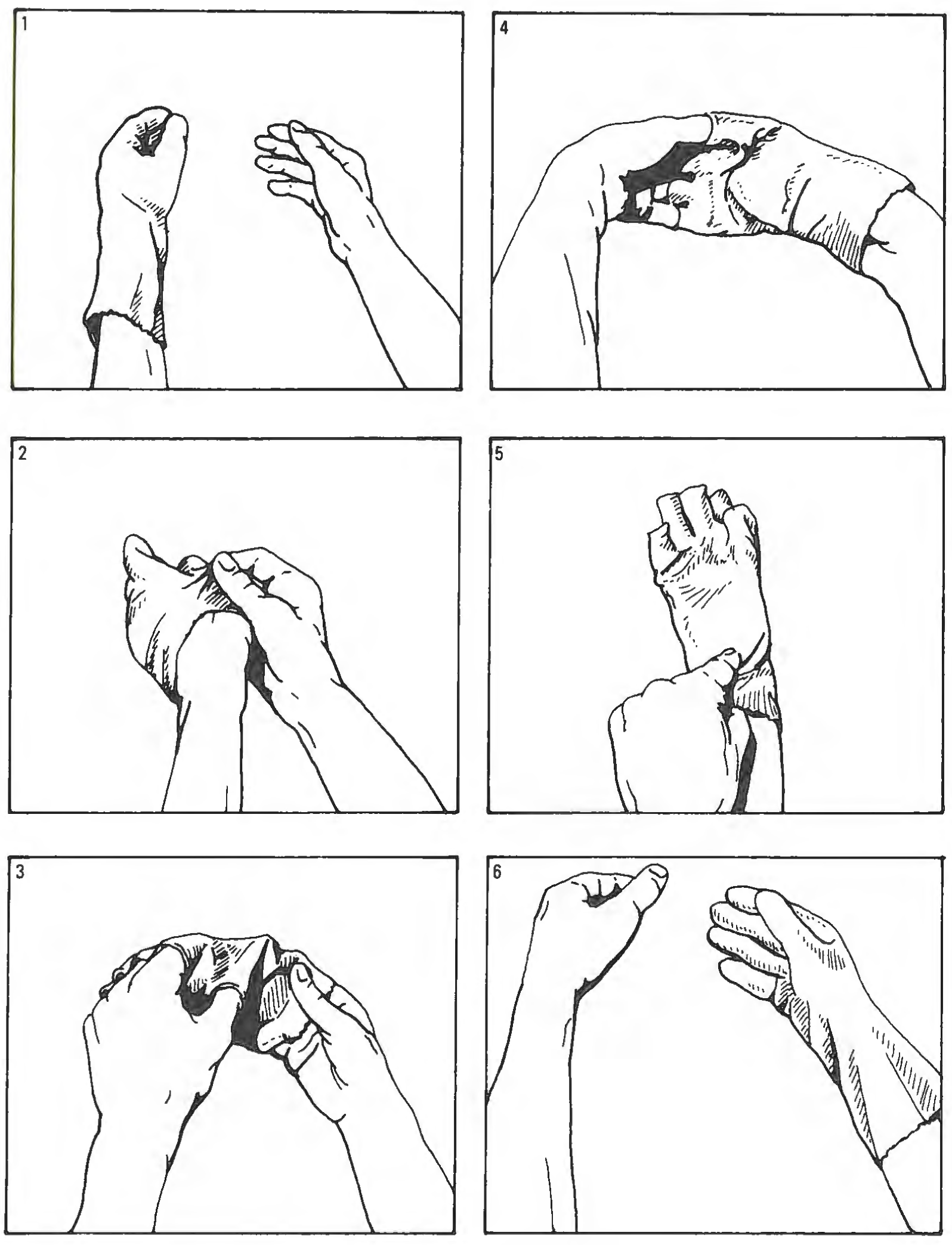Figure 84: Inside-outing of glove.